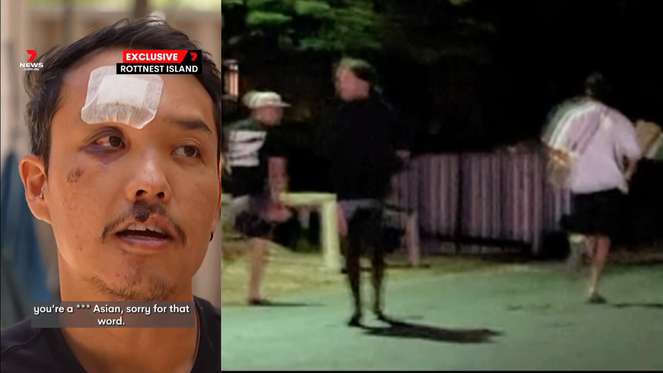 Anti-Asian racism: Brazilian – Japanese worker  gets racially and physically attacked in WA