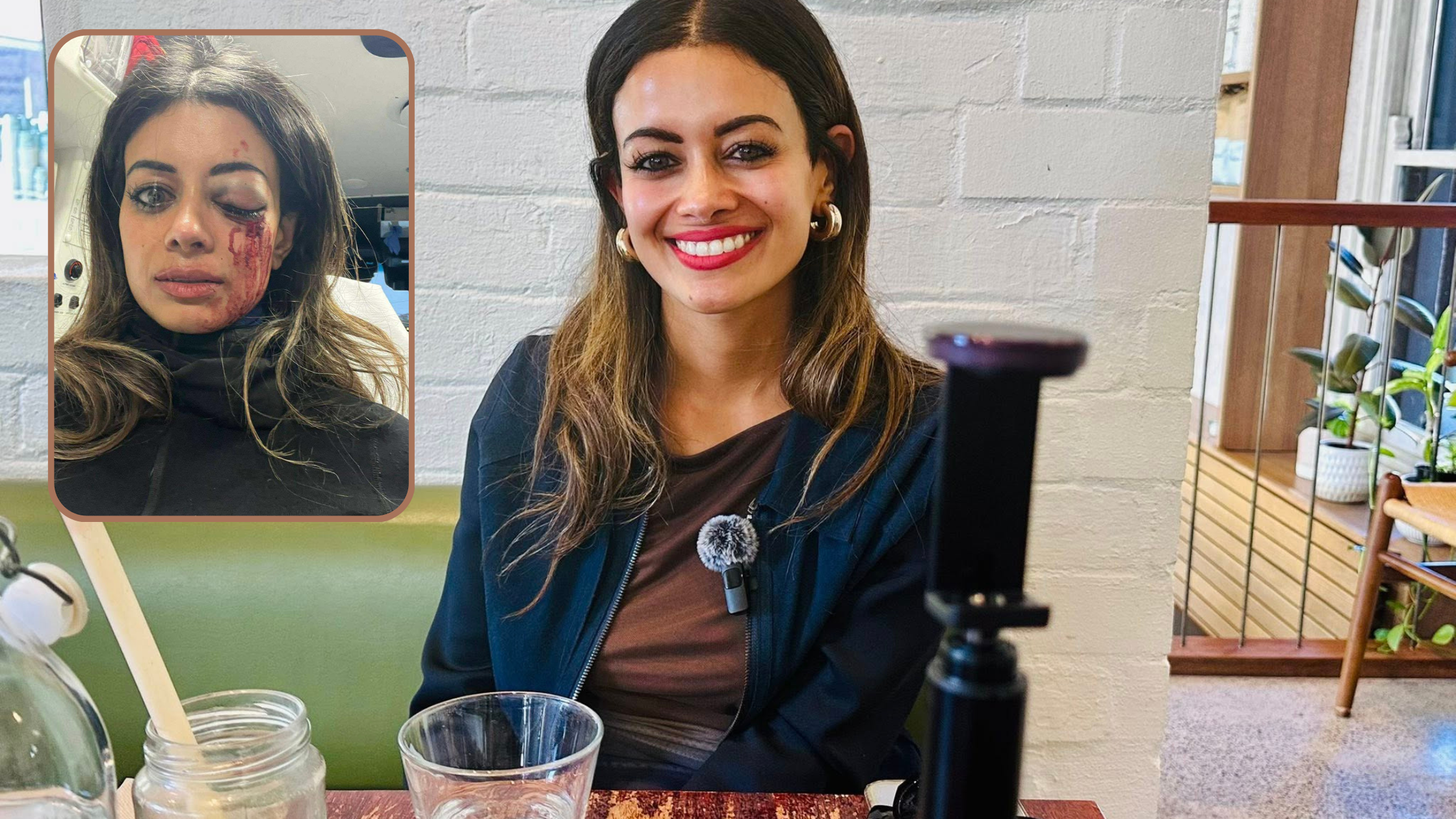 Former Greens candidate severely injured in 1 eye while being arrested at a pro-Palestinian protest